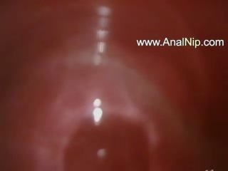 Sweet jap anal hairy x rated clip